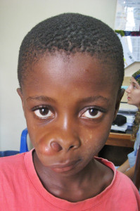 Mohamed Musa before surgery.