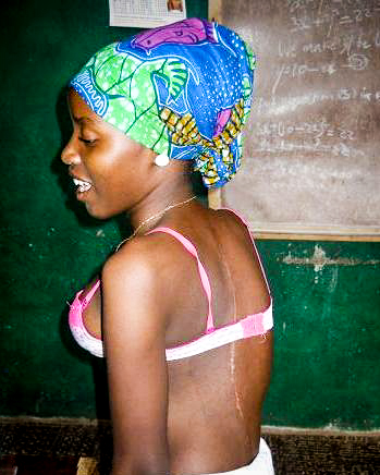 wpid585-Dankay-Bangura-after.jpeg wpid585-Dankay-Bangura-after.jpeg